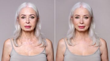 celebrity-plastic-surgeon-reveals-when-it’s-too-soon-for-a-facelift,-and-when-waiting-can-backfire