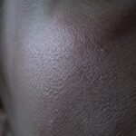 crazy-as-it-sounds,-there-are-probably-microscopic-mites-in-your-face-pores-that-come-out-at-night