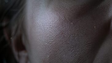 crazy-as-it-sounds,-there-are-probably-microscopic-mites-in-your-face-pores-that-come-out-at-night