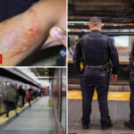 nyc-judge-fails-to-take-bite-out-of-crime-after-repeat-offender-chomps-on-cop