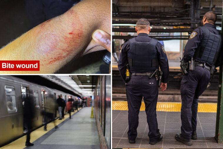nyc-judge-fails-to-take-bite-out-of-crime-after-repeat-offender-chomps-on-cop