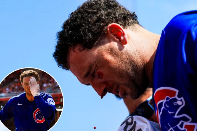 cubs’-alex-bregman-left-bloodied-with-eye-swollen-shut-after-being-struck-by-foul-ball-in-scary-scene