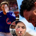 gruesome-alex-bregman-injury-revealed-— with-playoff-return-stunningly-in-play