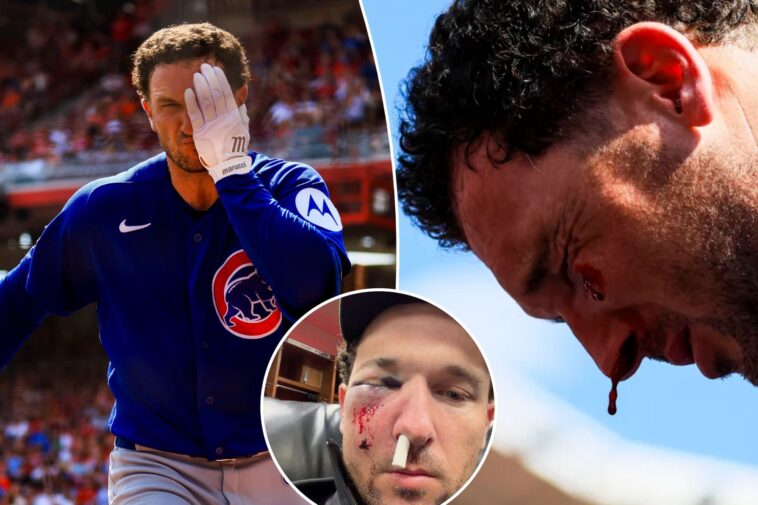 gruesome-alex-bregman-injury-revealed-— with-playoff-return-stunningly-in-play