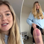 ‘devastated’-shark-attack-survivor-who-lost-an-arm-shares-sad-health-news-months-after-terrifying-incident