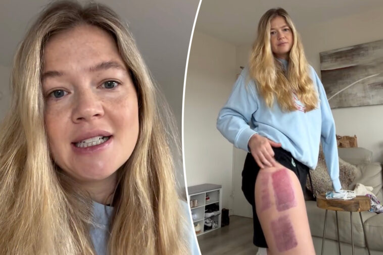 ‘devastated’-shark-attack-survivor-who-lost-an-arm-shares-sad-health-news-months-after-terrifying-incident