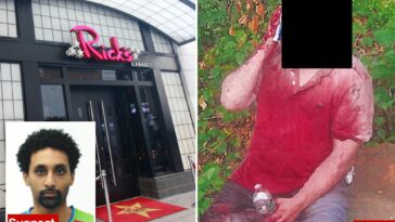 lawyer-visiting-nyc-for-work-abducted-outside-strip-club-—-before-being-beaten-bloody-and-ditched-in-nj:-feds