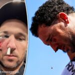 alex-bregman-could-return-quickly-after-getting-face-smashed-by-ball
