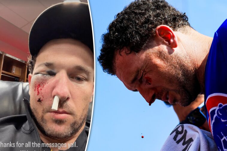 alex-bregman-could-return-quickly-after-getting-face-smashed-by-ball
