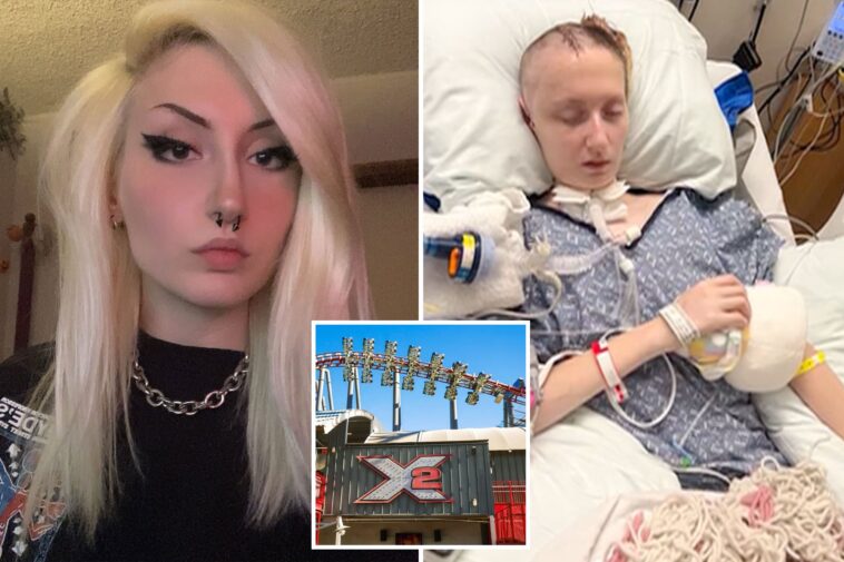 harrowing-pictures-shows-x2-rider-still-on-ventilator-two-months-after-riding-massive-six-flags-coaster