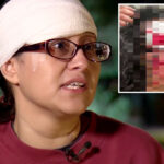 woman-accused-of-biting-chunk-out-of-victim’s-forehead-in-‘zombie-bite’-attack