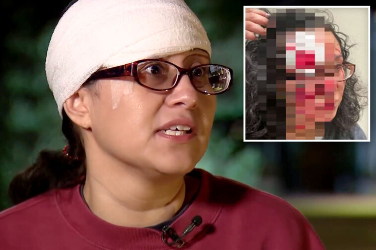woman-accused-of-biting-chunk-out-of-victim’s-forehead-in-‘zombie-bite’-attack