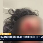 horror:-‘zombie’-attacker-bites-chunk-of-woman’s-face-off-in-seattle-in-racially-motivated-attack