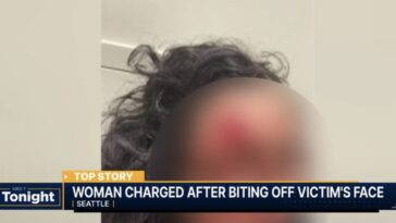 horror:-‘zombie’-attacker-bites-chunk-of-woman’s-face-off-in-seattle-in-racially-motivated-attack