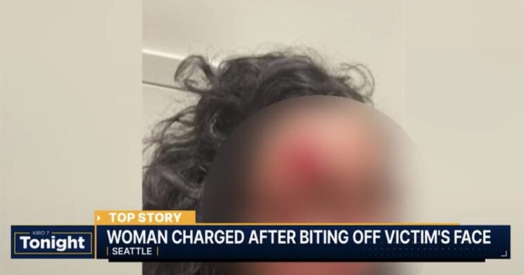 horror:-‘zombie’-attacker-bites-chunk-of-woman’s-face-off-in-seattle-in-racially-motivated-attack