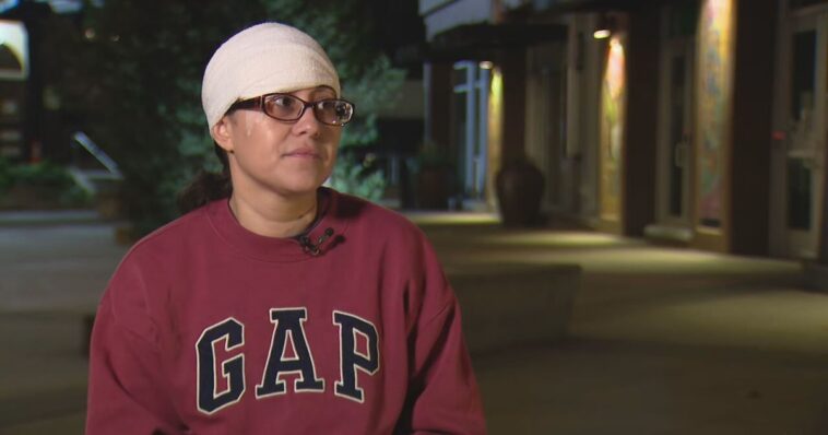 woman-with-african-name-screams-‘you’re-the-inferior-race,’-bites-literal-chunk-out-of-passerby’s-face-in-deep-blue-seattle