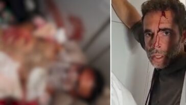 graphic-video-shows-blood-drenched-pilot-clinging-to-life-after-‘attempted-terror-attack’
