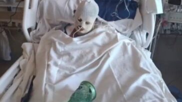 california-woman-left-with-horrific-injuries-after-being-covered-in-gas-and-set-on-fire-during-wild-fight