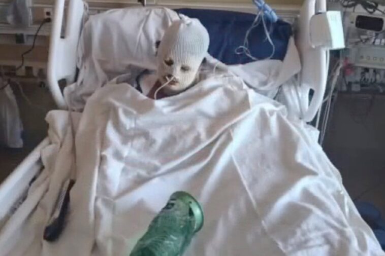 california-woman-left-with-horrific-injuries-after-being-covered-in-gas-and-set-on-fire-during-wild-fight