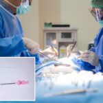 after-7-years-of-agony,-ny-mom-discovers-c-section-surgeons-left-a-needle-in-her-belly:-lawsuit