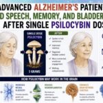shock-case-report:-advanced-alzheimer’s-patient-regains-speech,-memory,-mobility,-and-bladder-control-after-a-single-high-dose-of-psilocybin-containing-mushrooms