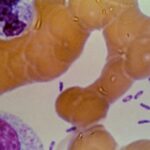 possible-plague-crisis-in-siberia:-five-hospitals-placed-under-quarantine-after-lab-tech-dies-following-test-tube-accident-containing-plague-bacteria
