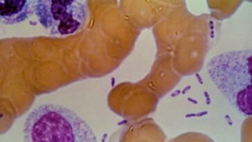 possible-plague-crisis-in-siberia:-five-hospitals-placed-under-quarantine-after-lab-tech-dies-following-test-tube-accident-containing-plague-bacteria