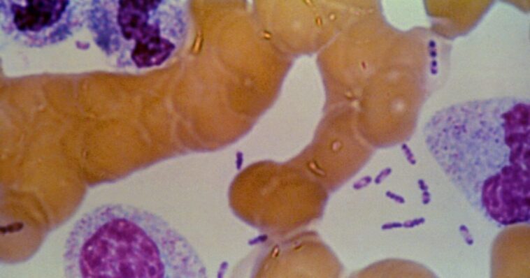 possible-plague-crisis-in-siberia:-five-hospitals-placed-under-quarantine-after-lab-tech-dies-following-test-tube-accident-containing-plague-bacteria