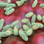us-monitoring-suspected-fatal-pneumonic-plague-case-in-russia,-state-department-official-says