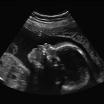 inside-the-government-decision-that-opened-up-abortion-pill-floodgates