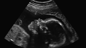 inside-the-government-decision-that-opened-up-abortion-pill-floodgates