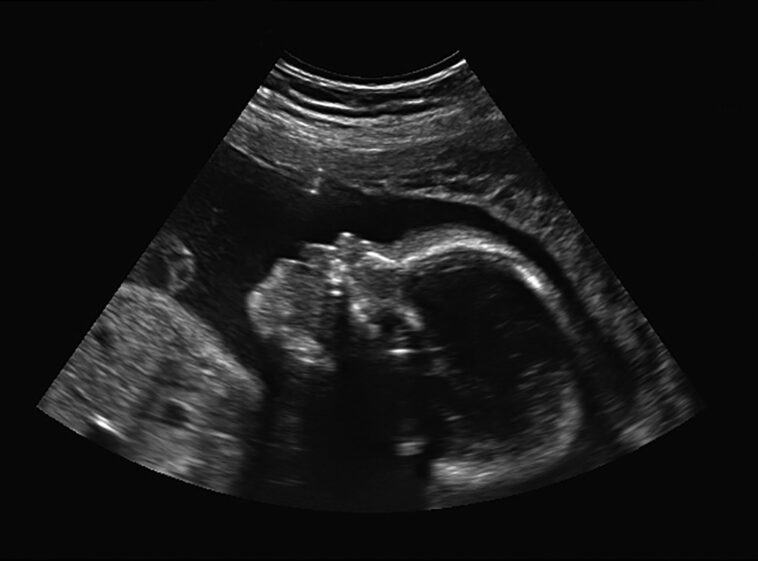 inside-the-government-decision-that-opened-up-abortion-pill-floodgates