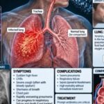 the-plague?-200-people-under-observation-–-a-reminder-that-the-next-pandemic-is-just-one-accident-away