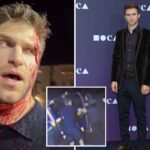 ‘pretty-little-liars’-star-pistol-whipped-in-terrifying-west-hollywood-robbery-calls-out-karen-bass,-gavin-newsom-after-attack