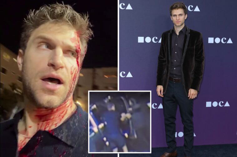 ‘pretty-little-liars’-star-pistol-whipped-in-terrifying-west-hollywood-robbery-calls-out-karen-bass,-gavin-newsom-after-attack