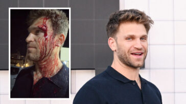 ‘pretty-little-liars’-star-keegan-allen-robbed-at-gunpoint-outside-luxury-hollywood-grocery-store