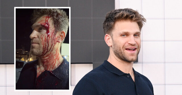 ‘pretty-little-liars’-star-keegan-allen-robbed-at-gunpoint-outside-luxury-hollywood-grocery-store