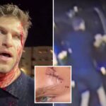 ‘pretty-little-liars’-star-keegan-allen-reveals-gruesome-injuries-after-violent-gunpoint-robbery-in-west-hollywood