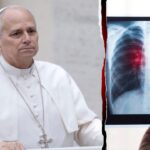 pope-leo’s-lung-tumor-raises-questions-about-cancer-risk-for-nonsmokers