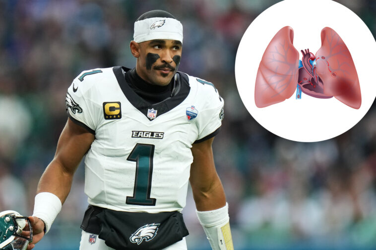 what-is-pulmonary-embolism?-the-serious-blood-clot-condition-sidelining-jalen-hurts
