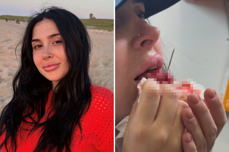 shady-nyc-piercing-shop-butchered-woman’s-tongue,-sending-her-to-er:-lawsuit